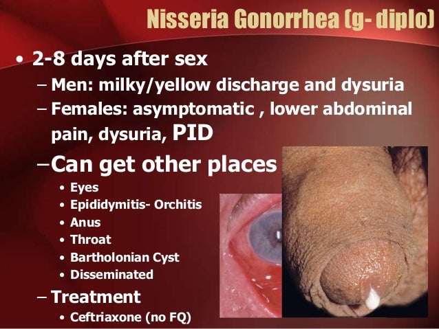 abdominal cramps after sex Abdominal cramps after sex